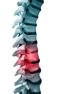 spinal-cord-injury-damage-200x300